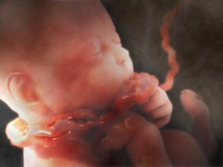 Nuchal Cord Injury